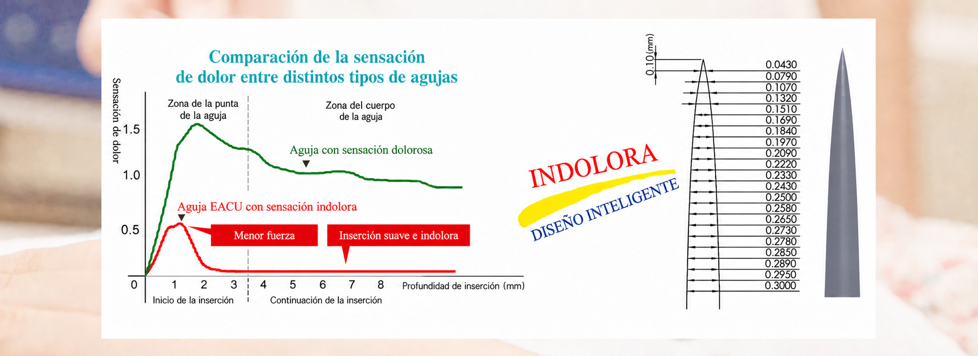 Bond Medical | Agujas de acupuntura