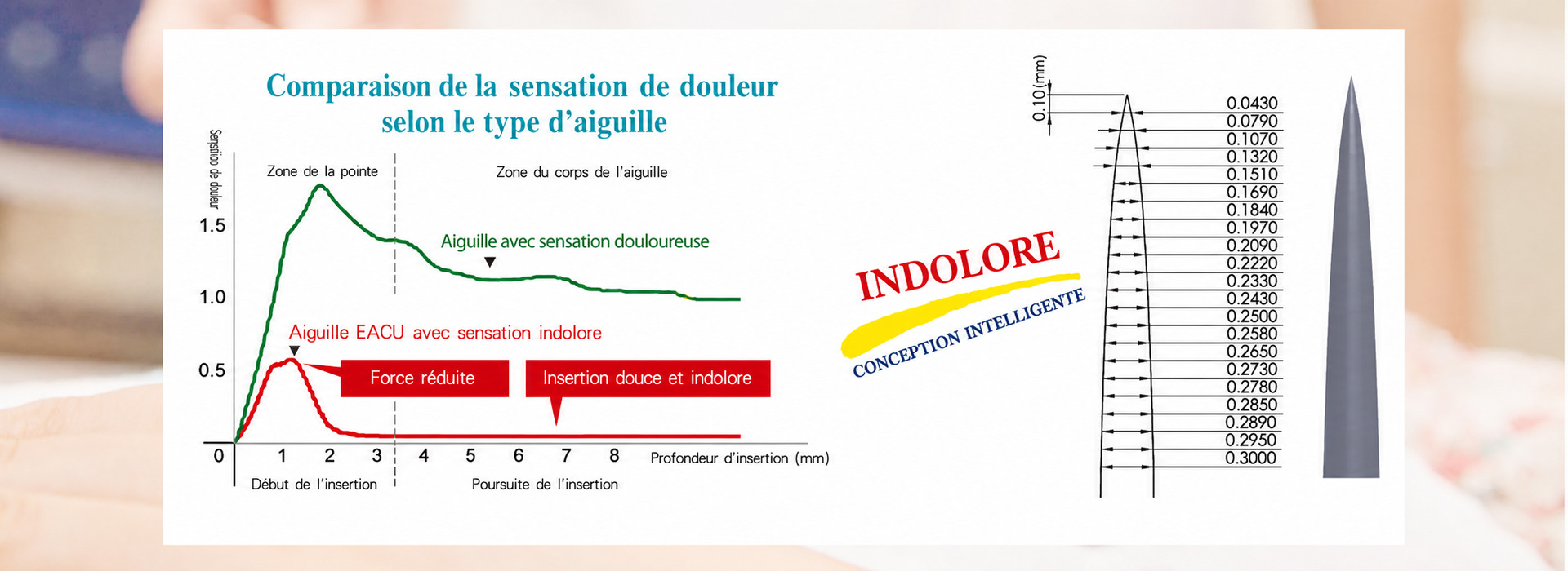 Bond Medical | Aiguilles d’acupuncture