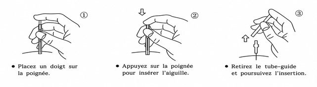 Aiguille sèche type Q — mode d’emploi