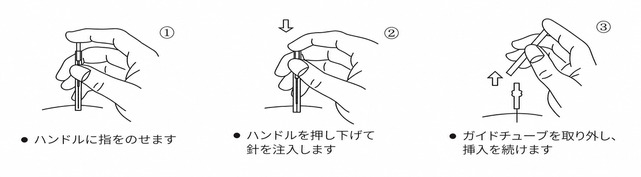 Q ドライニードル — 使用方法
