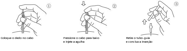 Agulha seca tipo Q — instruções de uso