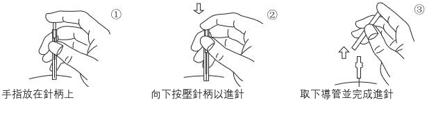 Q 乾針 — 使用說明